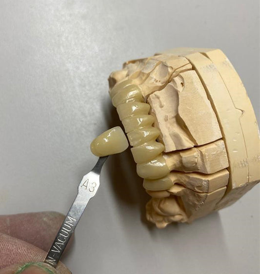 3D revolution case from a Brazil customer