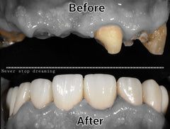 Vita A Shade 3D Revolution Zirconia